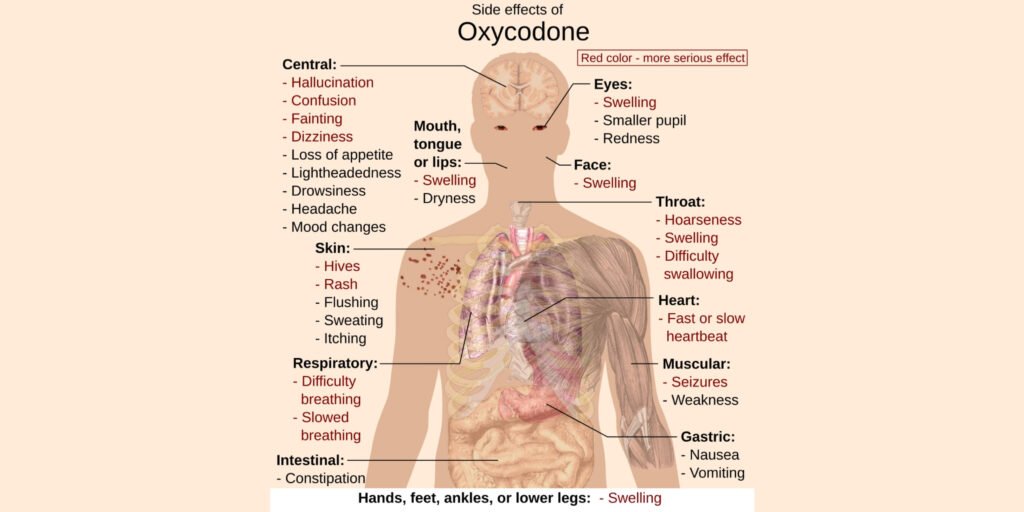 This medical illustration details the systemic side effects of oxycodone use, including central nervous system effects like confusion and dizziness, respiratory issues like slowed breathing, and physical symptoms like swelling and rash.