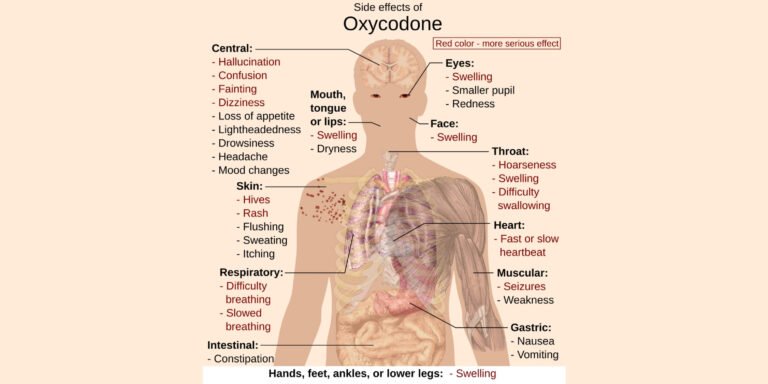 This medical illustration details the systemic side effects of oxycodone use, including central nervous system effects like confusion and dizziness, respiratory issues like slowed breathing, and physical symptoms like swelling and rash.